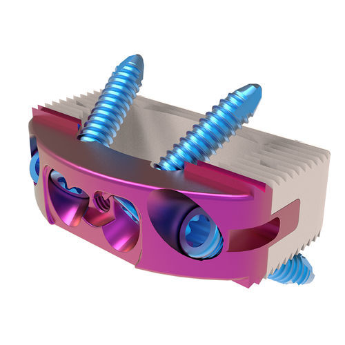 Thorako-lumbales Zwischenwirbelimplantat - Esa  - NORMMED Medical Devices - ventraler Zugang / aus PEEK