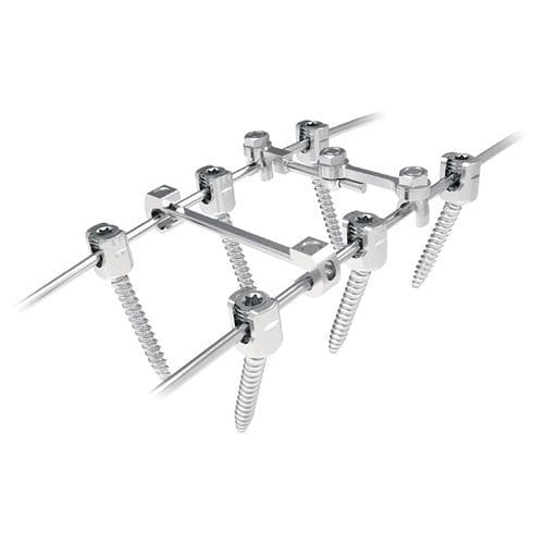 Thorako-lumbales Stabilisierungssystem für Osteosynthese - Silver  - NORMMED Medical Devices - dorsaler Zugang / für Erwachsene