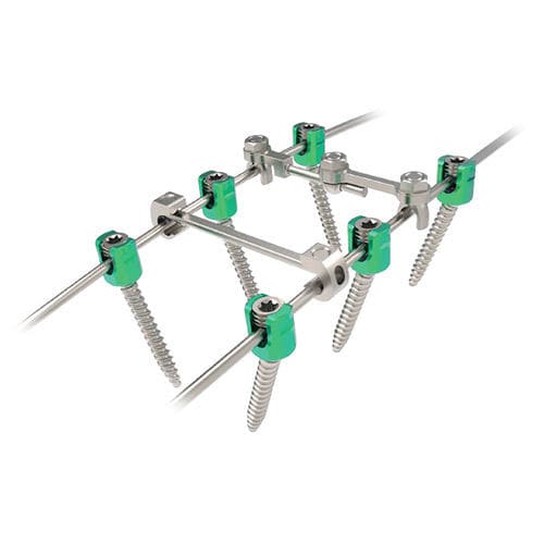 Thorako-lumbales Stabilisierungssystem für Osteosynthese - Rapidfix  - NORMMED Medical Devices - dorsaler Zugang / für Erwachsene