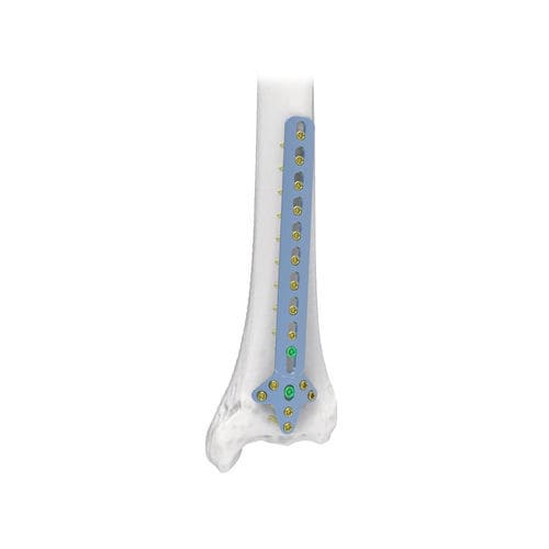Kompressionsplatte für Humerus - NORMMED Medical Devices - distal / mit Verriegelung