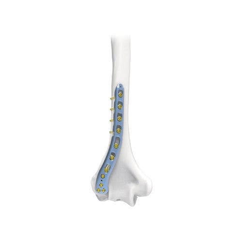 Kompressionsplatte für Humerus - NORMMED Medical Devices - distal / dorsolateral / mit Verriegelung