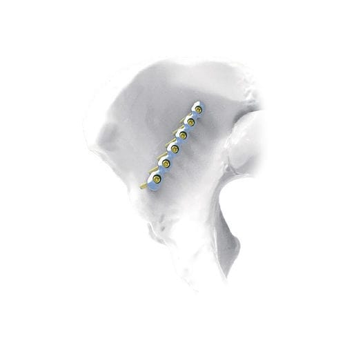Kompressionsplatte für Becken - Straight - NORMMED Medical Devices - mit Verriegelung / Metall