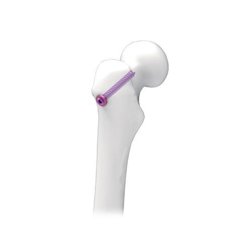 Knochen-Kompressionsschraube / für Oberschenkelknochen - NORMMED Medical Devices - kanüliert / Metall