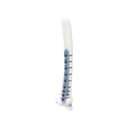 Knochen-Kompressionsschraube / für Radius - NORMMED Medical Devices - Metall