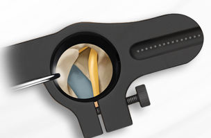 Wirbel-Retraktor - SOAR™ - Spineology - für orthopädische Chirurgie / für Neurochirurgie