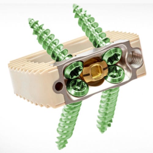 LWS-Zwischenwirbelimplantat - Spineology - ventraler Zugang / aus PEEK