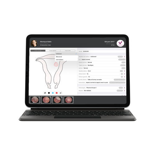 Medizinische Software - imagyn® license - Delmont imaging - für medizinische Bildgebung / Gynäkologie / Datenverwaltung