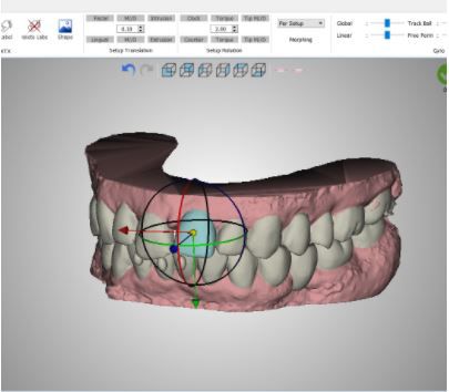 Orthodontische Software - PLAN - VERSION 5.0 - Orchestrate Orthodontic Technologies - Steuerung / Projektentwicklung / Windows