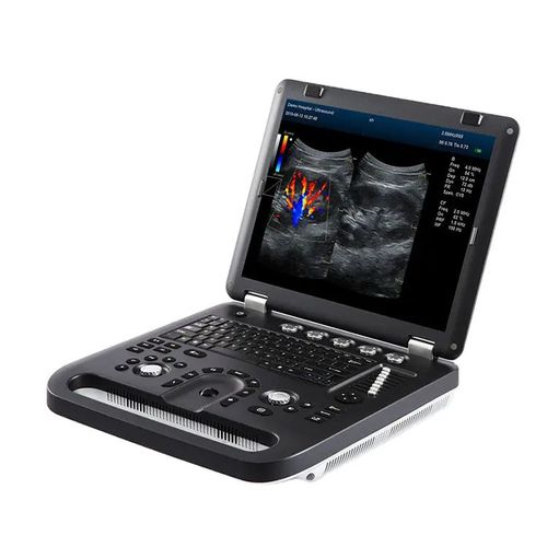 Tragbares Ultraschallgerät - M60  - Hunan Fude Technology - für Multifunktions-Ultraschall / Schwarz-Weiß / Farbdoppler