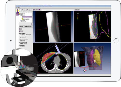Software-Modul / für Strahlentherapie - EPIgray® - DOSIsoft - Strahlendosimetrie