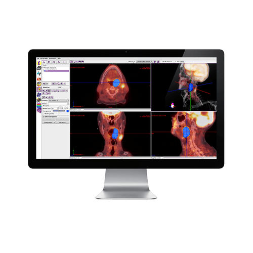 Kantendetektions-Software - IMAgo - DOSIsoft - für Strahlentherapie