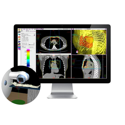 Software für Strahlentherapie - SIMAgo - DOSIsoft - Simulation