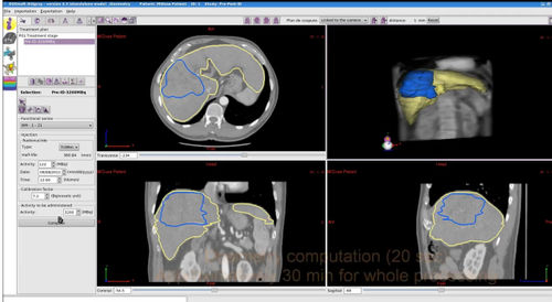 Software für Strahlentherapie - PLANET® Dose - DOSIsoft - zur Kalibrierung der Dosis / Bestätigung