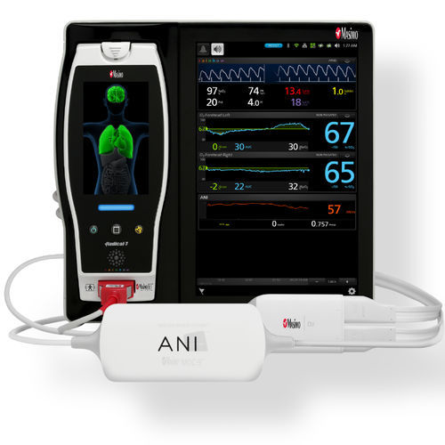 Modul für Patientenmonitor / ANI - ANI MOC-9 V1 - Mdoloris Medical Systems - Schmerzfreiheit / für Intensivpflege / für OP-Saal