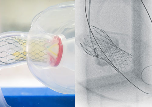 Anatomisches Modell / Aortenklappen - TAVI  - JMC Corporation - für Kllappenrekonstruktion