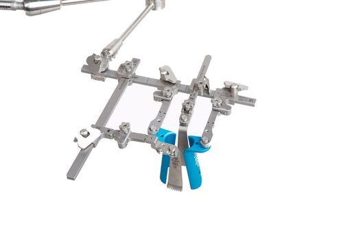 LWS-Retraktor - ML-2000 - TeDan Surgical Innovations - OP