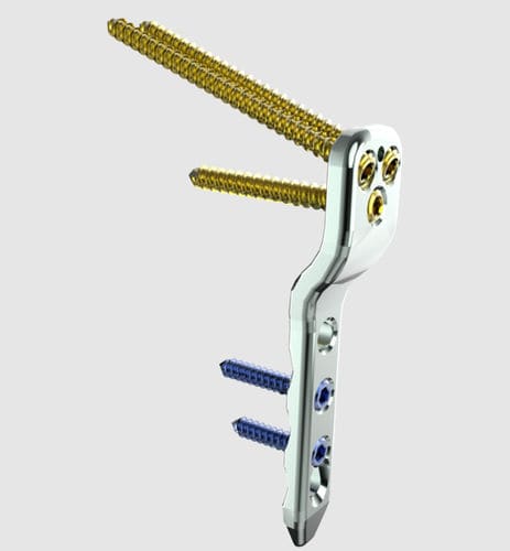 Osteotomieplatte für Oberschenkelknochen - 31610 series - Peditst - proximal / mit Verriegelung / Edelstahl