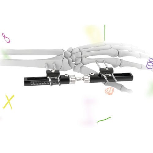 Fixateur externe / für Handgelenk - WristX  - Peditst - rohrförmig / für Kinder