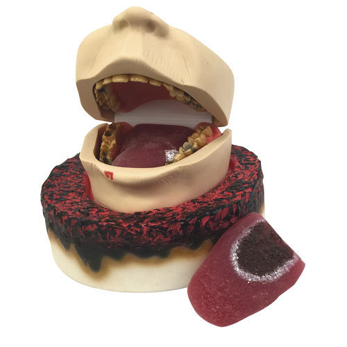 Anatomisches Modell / mit Auswirkungen des Rauchens - 79287 - Health Edco & Childbirth Graphics - Mund / interaktiv