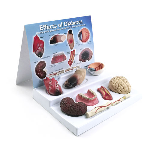 Anatomisches Modell / für Diabetes - 78792 - Health Edco & Childbirth Graphics - Fuß / Herz / Arterie