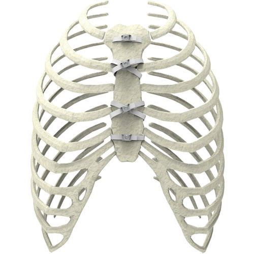 Cerclagekabel für Sternum-Verschluss - Ortolog Medikal