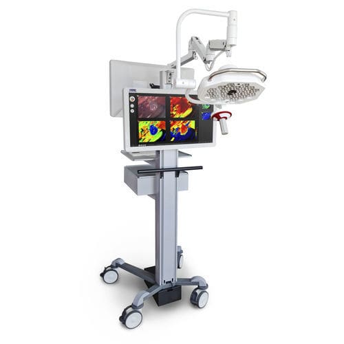 Medizinische Kamera - TIVITA 2.0 - Diaspective Vision GmbH - hyperspektral / HD / mobil