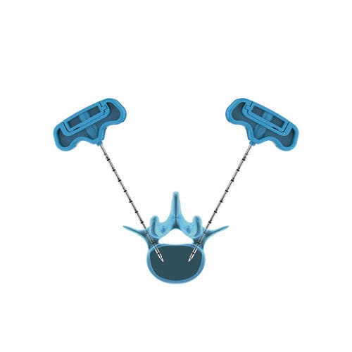 Vertebroplastie-System / Nadel - PVP - Hicren Zhejiang Medtech - für perkutane Vertebroplastie