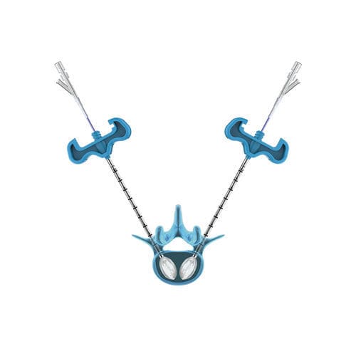 Vertebroplastie-System / Ballonkatheter - PKP - Hicren Zhejiang Medtech - für perkutane Kyphoplastie