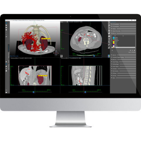 Analysesoftware - Medip - MEDICALIP Co., Ltd. - Mess / 3D-Druck / Modellierung