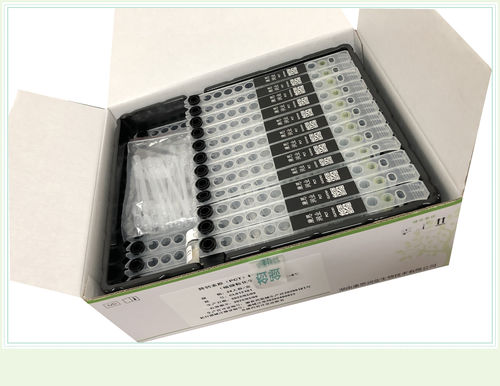 Testkit für kardiovaskuläre Erkrankungen - 0007HC - Beijing O&D Biotech Co., Ltd. - Kreatin-Kinase / Serum / CLIA