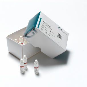 Serum-Reagenzkit - 36158 - SSI Diagnostica - Antiserum / Antikörper / Serologie