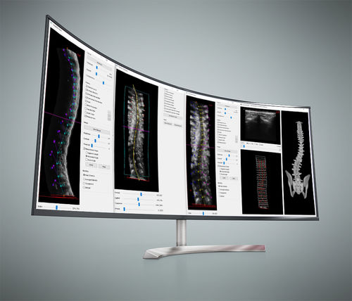 Analysesoftware - Scoliostudio® - Scolioscan - 3D-Visualisierung / Mess / für Kliniken