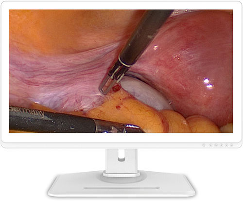 Monitor für Endoskopie - 32A30 - KTC Medical Solutions - 3840 × 2160 / 31,5" / HDMI