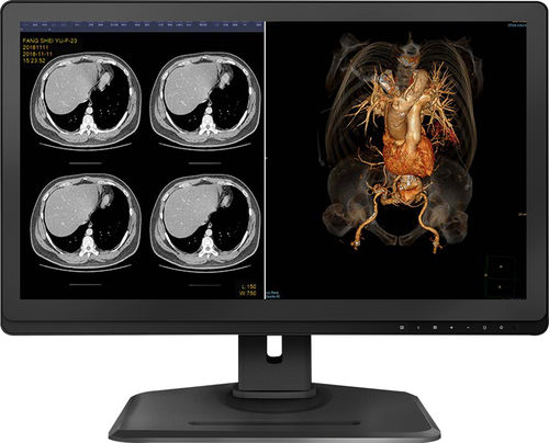QHD-Monitor - 27X4C-I - KTC Medical Solutions - 27" / HDMI / DisplayPort