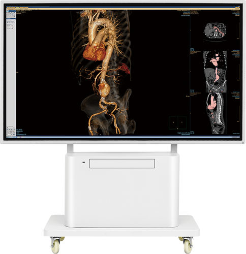 Monitor / 3840 × 2160 - 55C10 - KTC Medical Solutions - 55" / HDMI / DisplayPort