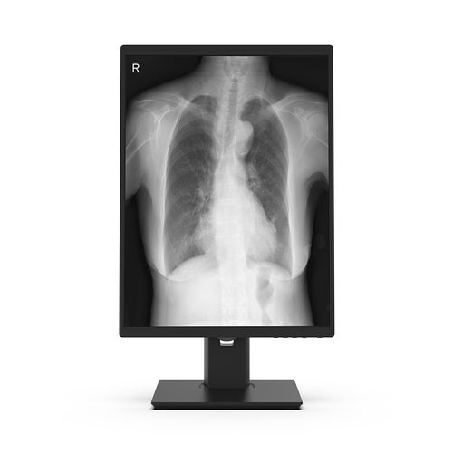 Medizinisch Monitor - 21X3M-I3 - KTC Medical Solutions - OP / Diagnose / für Radiologie