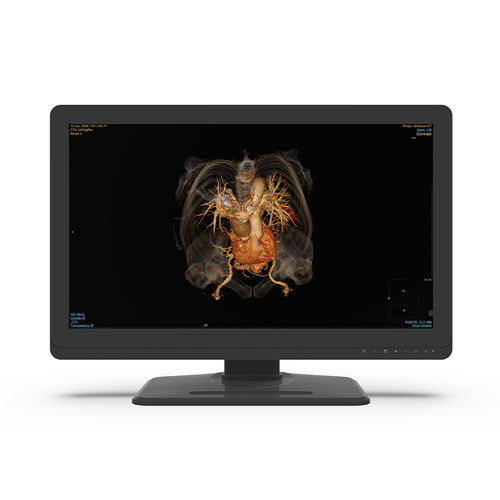 Medizinisch Monitor - 27X4C-I0 - KTC Medical Solutions - Diagnose / für Radiologie / QHD