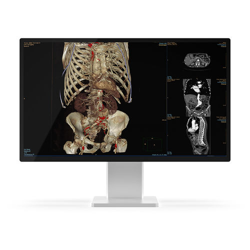 Medizinisch Monitor - 27X4C-K1 - KTC Medical Solutions - Diagnose / für Radiologie / QHD