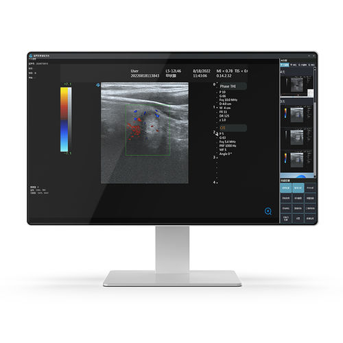 Medizinischer PC / Intel® Core i7 - 24H32 - KTC Medical Solutions - für Computerwagen / für Gesundheitseinrichtungen / für medizinische Bildgebung