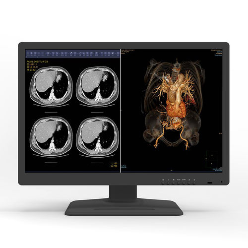 Medizinisch Monitor - 30X6C - KTC Medical Solutions - Diagnose / für Radiologie / 30"