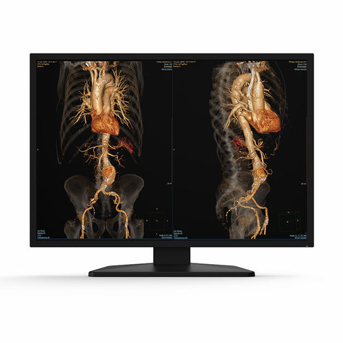 Medizinisch Monitor - 31X12C - KTC Medical Solutions - Diagnose / für Radiologie / 4K