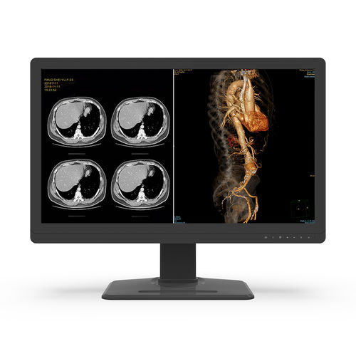 Medizinisch Monitor - 32X8C-L0S - KTC Medical Solutions - Diagnose / für Radiologie / 3840 × 2160