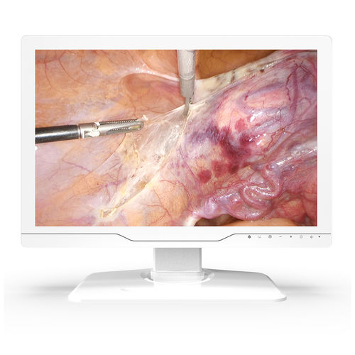 Medizinisch Monitor - 24A30 - KTC Medical Solutions - für OP-Bereich / für Endoskopie / 1920x1200
