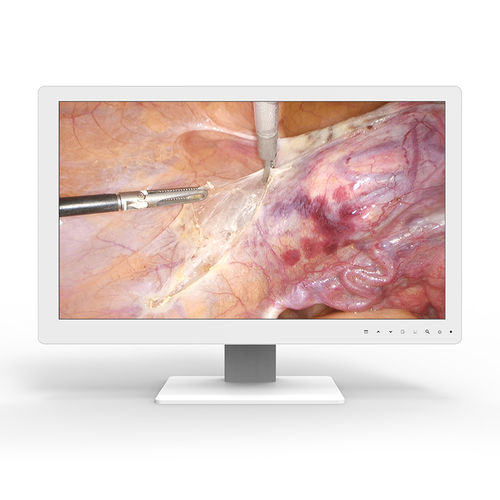 Medizinisch Monitor - 24A25-B0 - KTC Medical Solutions - für OP-Bereich / für Endoskopie / 1920 x 1080
