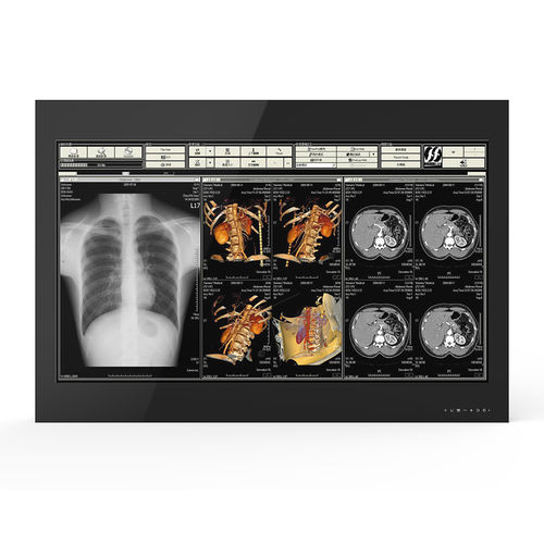 Medizinisch Monitor - 55H90 - KTC Medical Solutions - für OP-Bereich / 3840 × 2160 / 55"
