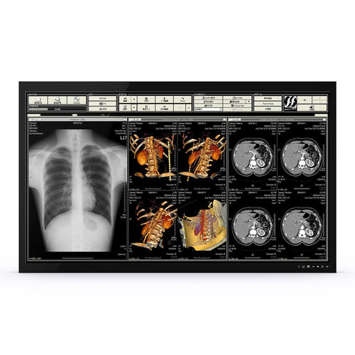 Medizinisch Monitor - 65H90 - KTC Medical Solutions - für OP-Bereich / 3840 × 2160 / 65"
