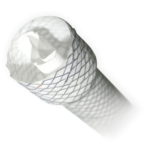 Speiseröhren-Stent - BRAVO - MITRA Industries - Metall
