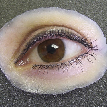 Kosmetische Orbitalprothese - Medical Art Prosthetics - für Erwachsene