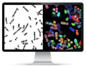 Automatisches Zell-Imaging-System - HiBand™ - Applied Spectral Imaging - Labor / Diagnose / Zytogenetisch