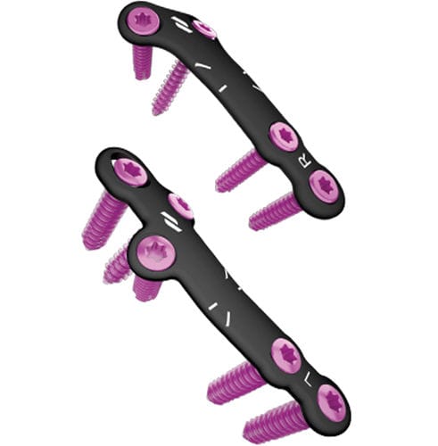 Arthrodeseplatte für Metatarsophalangealgelenk - Airlock® - novastep - für Hallux Valgus / dorsal / ohne Verriegelung